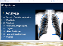 SVMTRA : La radiographie du thorax